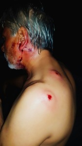 Brutal represión sufrida por el sindicalista ´Julio López